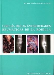Cirugía de las Enfermedades Reumáticas de la Rodilla