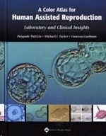Color Atlas Of Human Assisted Reproduction