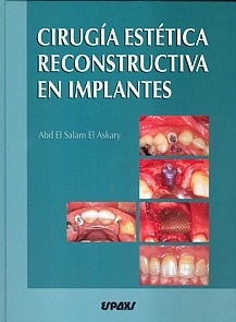 Cirugía Estética Reconstructiva en Implantes