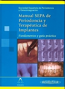 Manual SEPA de Periodoncia y Terapéutica de Implantes "Fundamentos y Guia Practica"