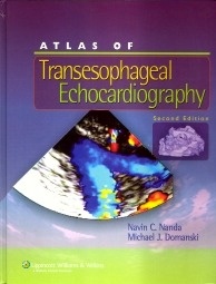 Atlas Of Transesophageal Echocardiography