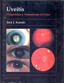 Uveitis. Diagnostico y Tratamiento "En Color"