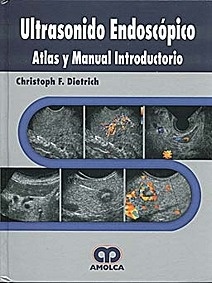 Ultrasonido Endoscopico "Atlas y Manual Introductorio"