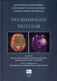 Neuroimagen Nuclear