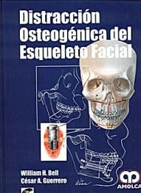 Distraccion Osteogenica del Esqueleto Facial + Cd-Rom