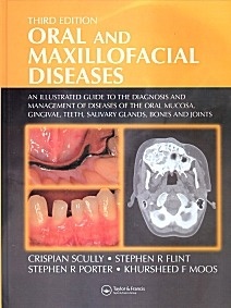 Oral and Maxillofacial Diseases "An Illustrated Guide to Diagnosis and Management of Diseases of. An Illustrated Guide to Diagnosis and Management of Diseases of the Oral Mucosa, Gingivae, Teet"