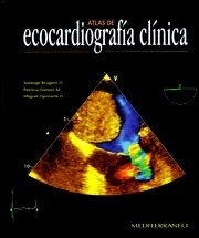 Atlas de Ecocardiografía