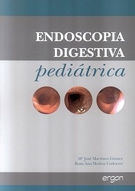 Endoscopia Digestiva Pediátrica