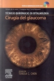 Cirugía del Glaucoma "Incluye Dvd-Rom"