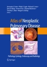 Atlas of Neoplastic Pulmonary Disease "Pathology, Cytology, Endoscopy and Radiology"