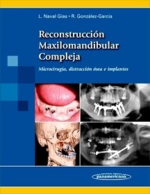 Reconstrucción Maxilomandibular Compleja