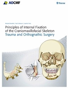 AO Principles of Internal Fixation of the Craniomaxillofacial Skeleton "Trauma and Orthognathic Surgery"