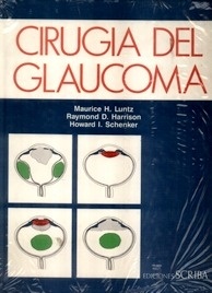 Cirugia del Glaucoma