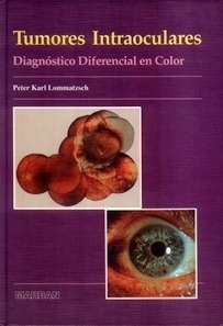 Tumores Intraoculares.Diagnóstico Diferencial