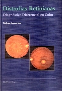 Distrofias Retinianas