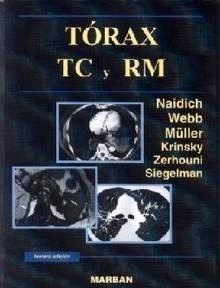 Torax TC y RM