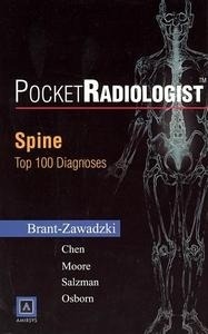 Pocket Radiologist Spine Top 100 Diagnoses