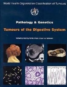 Tumors of the Digestive System. Vol. 2 "Pathology and Genetics"