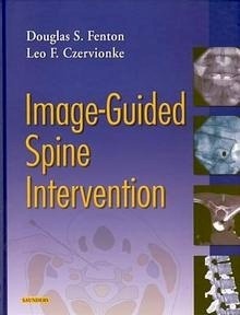 Image Guided Spine Intervention