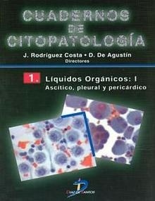 Líquidos Orgánicos: 1 Ascítico, Pleural y Pericardico Tomo 1 "Cuadernos de Citopatología"