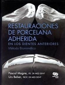 Restauraciones de Porcelana Adherida en los Dientes Anteriores "Método Biomimético"