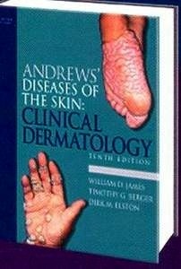 Andrews's Diseases of Skin