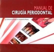Manual de Cirugia Periodontal
