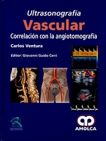 Ultrasonografia Vascular "Correlación con la Angiotomografía"