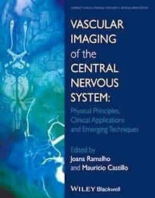 Vascular Imaging of the Central Nervous System "Physical Principles, Clinical Applications and Emerging Techniques"