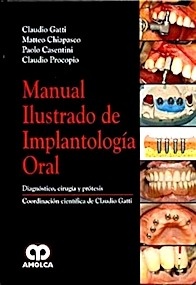 Manual Ilustrado de Implantología Oral