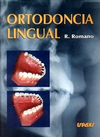 Ortodoncia Lingual