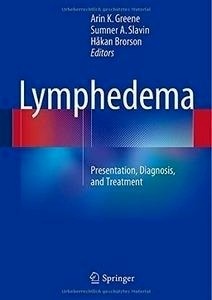 Lymphedema "Presentation, Diagnosis, And Treatment"