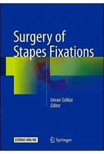 Surgery Of Stapes Fixation