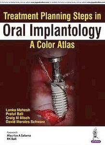 Treatment Planning Steps in Oral Implantology "A Color Atlas"