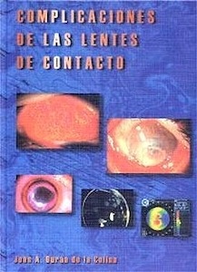 Complicaciones de las Lentes de Contacto