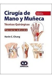 Cirugía de Mano y Muñeca "Técnicas Quirúrgicas"