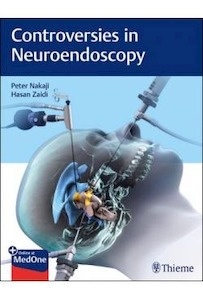 Controversies In Neuroendoscopy