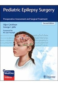 Pediatric Epilepsy Surgery "Preoperative Assessment And Surgical Treatment"