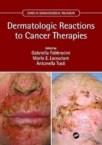 Dermatologic Reactions to Cancer Therapies