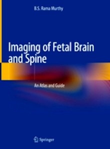 Imaging of Fetal Brain and Spine "An Atlas and Guide"