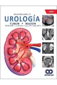 Imagenología en Urología