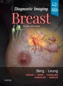 Diagnostic Imaging: Breast