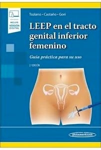 Leep en el Tracto Genital Inferior Femenino "Guía Práctica para su Uso"