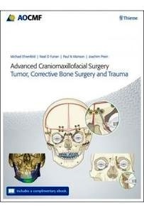 Advanced Craniomaxillofacial Surgery "Tumor  Corrective Bone Surgery And Trauma"