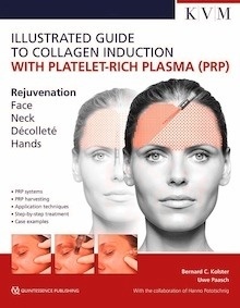 Illustrated Guide to Collagen Induction with Platelet-Rich Plasma (PRP) "Rejuvenation. Face. Neck. Décoletté. Hands"