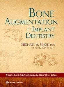Bone Augmentation In Implant Dentistry "A Step-by-Step Guide to Predictable Alveolar Ridge and Sinus Grafting"
