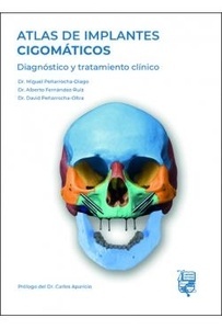Atlas de Implantes Cigomáticos "Diagnóstico y Tratamiento Clínico"