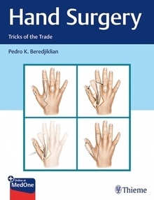 Hand Surgery "Tricks of the Trade"