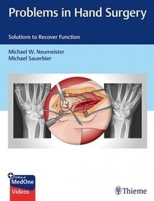 Problems in Hand Surgery "Solutions to Recover Function"