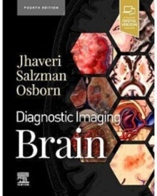 Diagnostic Imaging. Brain